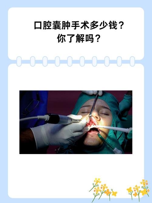 口腔手车如何正确启动？操作步骤有哪些？-图3
