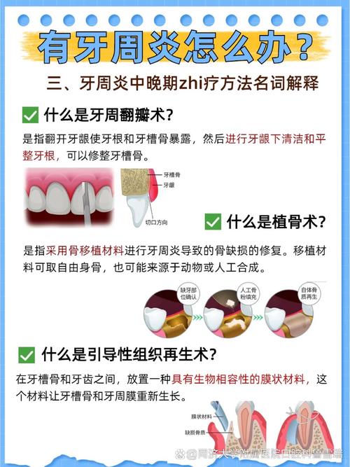 正畸期间患上牙周炎，该如何应对和处理？-图3
