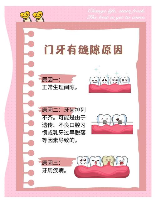 正畸后门牙缝隙如何有效关闭?-图1 正畸后门牙缝隙如何有效关闭?-图1