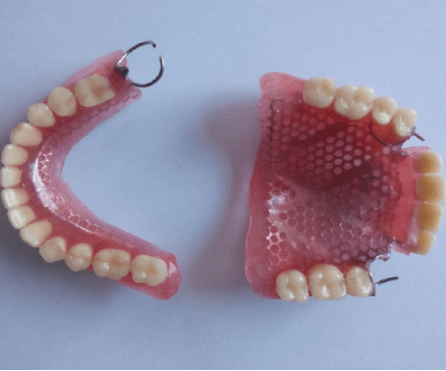 如何掌握临时义齿制作的核心方法与注意事项？-图3