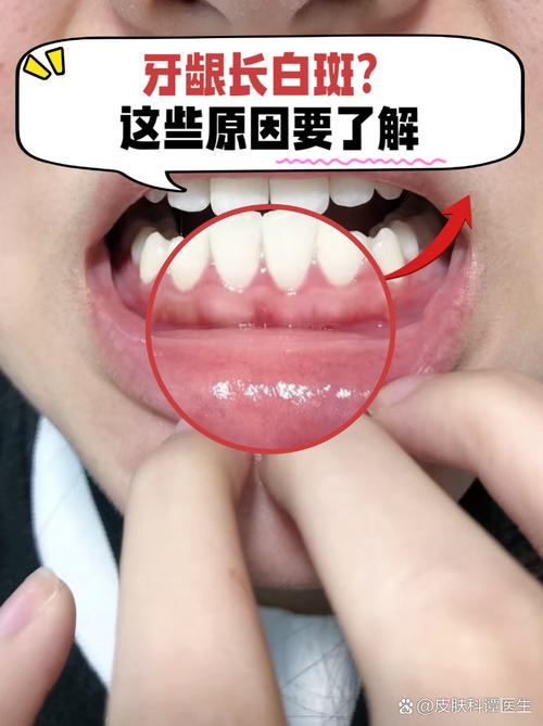 医院牙齿变白的方法安全又有效吗？-图2