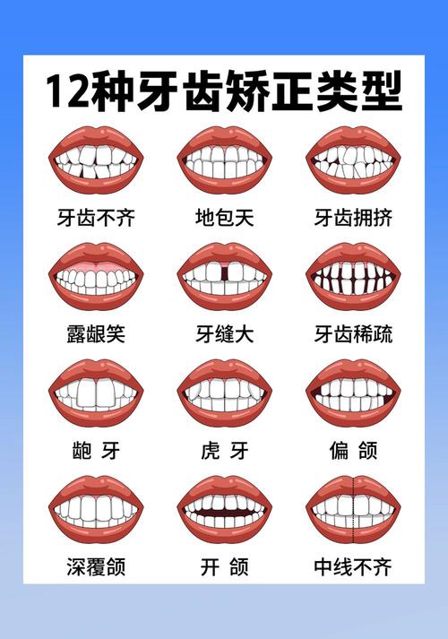 牙齿具体有多少种常见问题？-图2