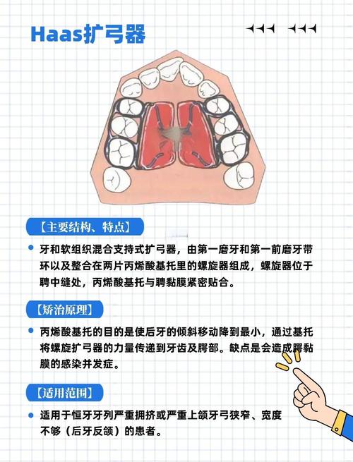 正畸模型制作的关键步骤与注意事项有哪些？-图2
