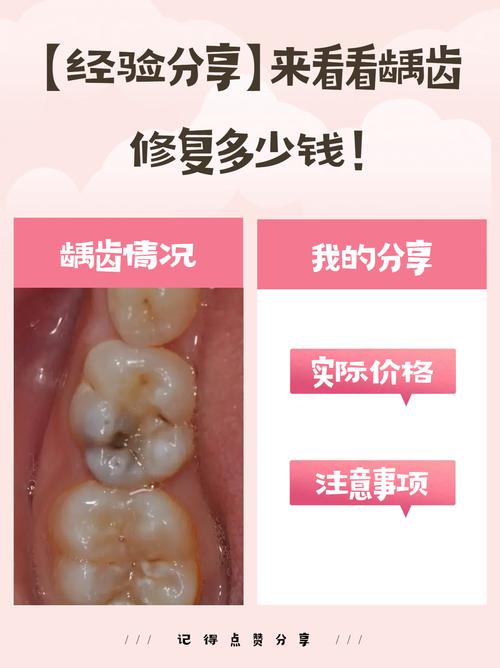 龋坏组织去除方法有哪些？哪种更安全有效？-图2