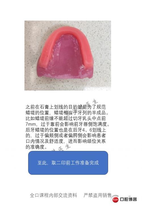 传统假牙制作方法的具体步骤有哪些？-图1