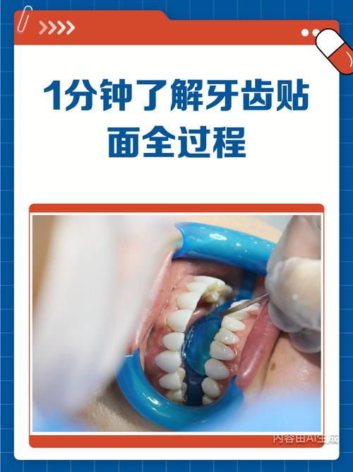 贴面方法和步骤的关键步骤有哪些？-图1