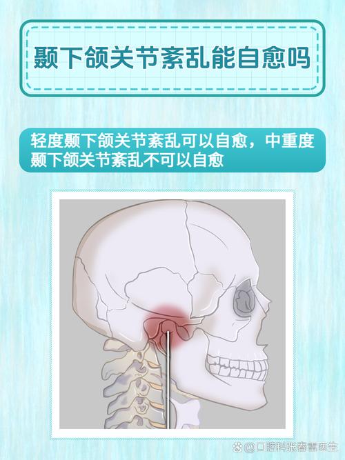 正畸中颞下颌关节疼痛是什么原因导致的？-图2