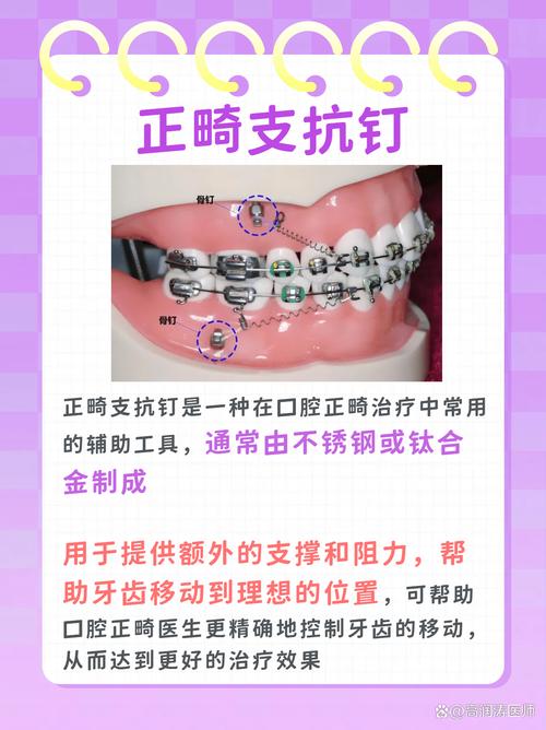 正畸种植支抗打开咬合的原理与效果如何？-图3