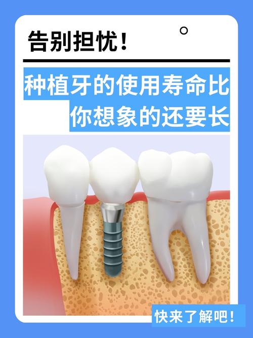 种牙寿命到底能维持多久？哪些因素会影响其长短？-图2