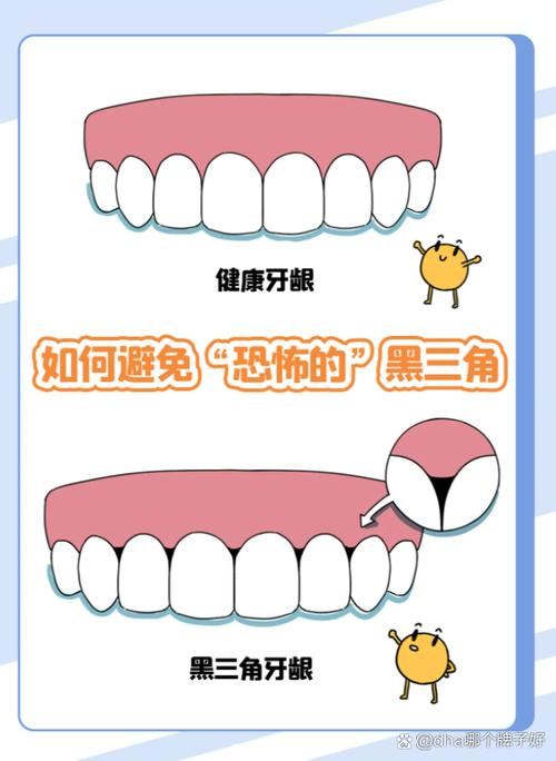 牙龈发炎会影响正畸治疗的顺利进行吗?-图1 牙龈发炎会影响正畸治疗的顺利进行吗?-图1