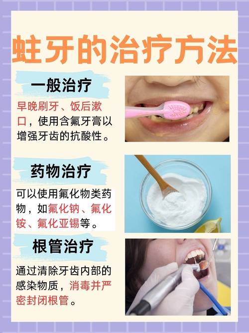 轻度虫牙有哪些有效的治疗方法？-图2