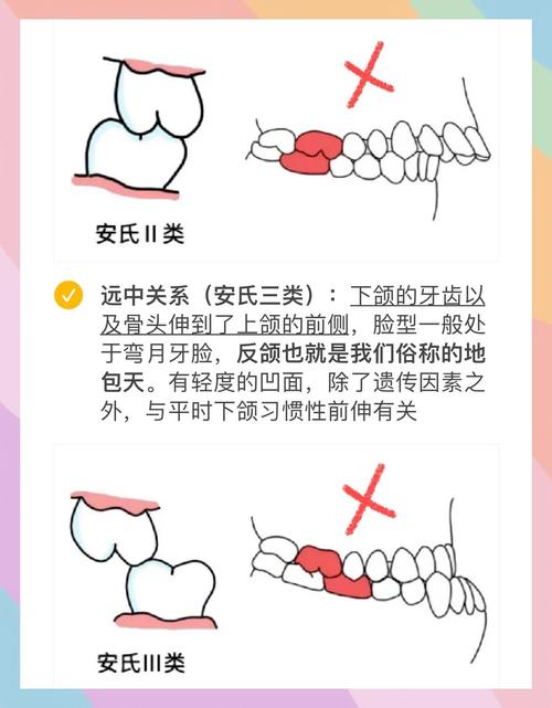正畸治疗中，咬合关系具体可以分为哪几种类型？-图3