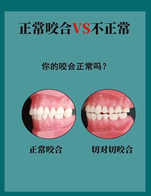 正畸治疗中，咬合关系具体可以分为哪几种类型？-图1
