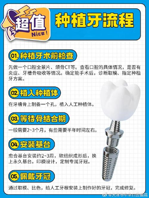 口腔种植治疗方法有哪些常见选择？-图2