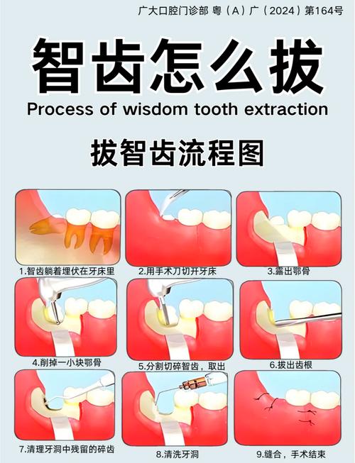 种牙需要拔牙根么-图2