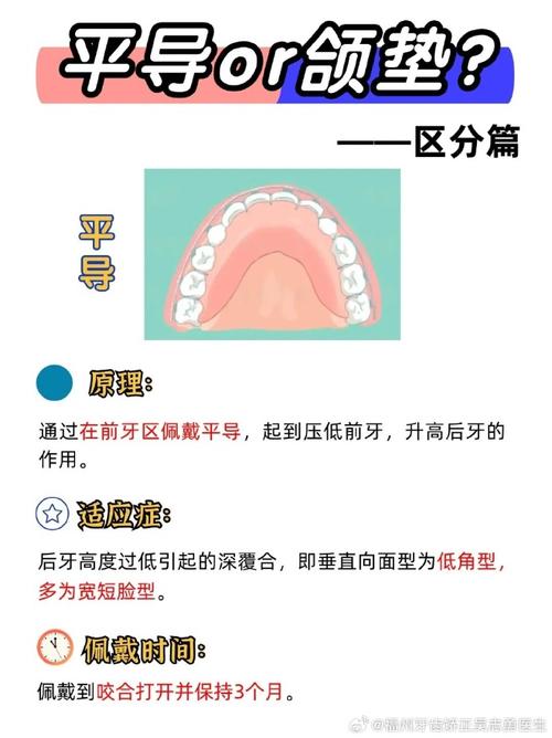 正畸弹簧在牙齿矫正中起什么具体作用？-图1