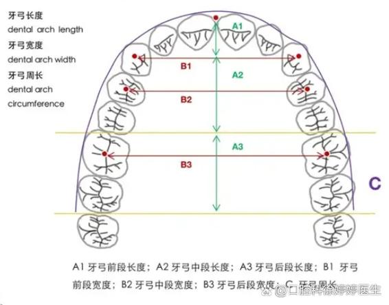 缺牙正畸关闭间隙，图解详解如何实现？-图2