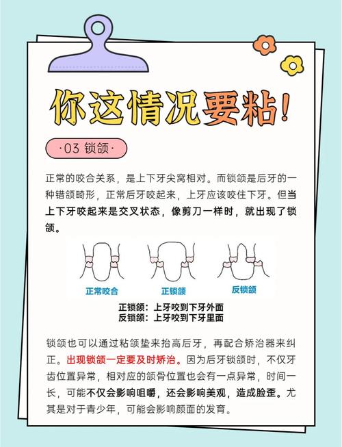 正畸治疗中摩擦力能抵消多少矫治力？-图3