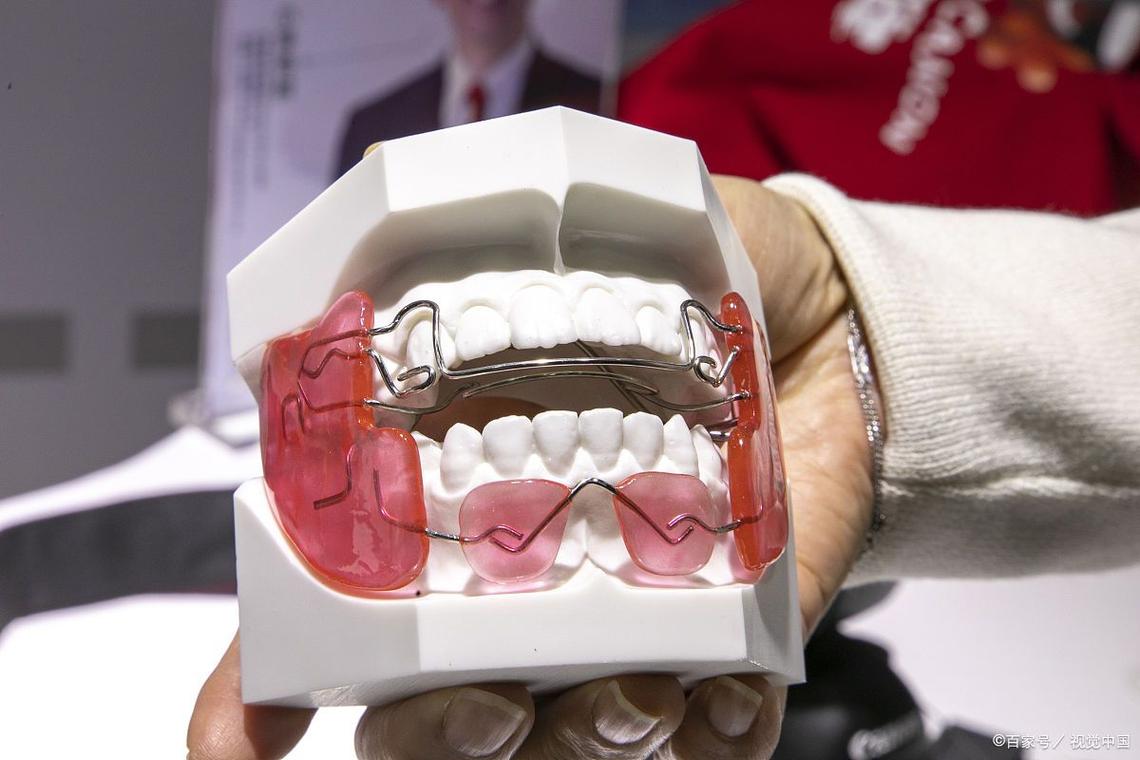 正畸标准弓形弯制如何精准弯制出标准形态？-图1