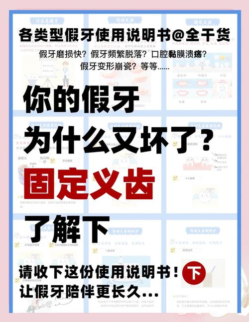 固定假牙护理方法-图1