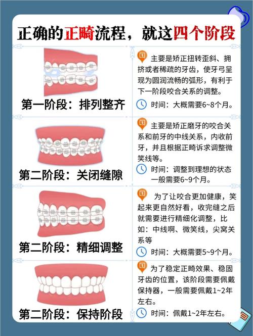 正畸中线调整方法书籍有哪些实用技巧与方法？-图2