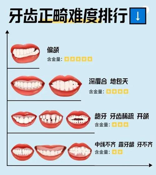 咬合不齐的有效治疗方法有哪些？-图2