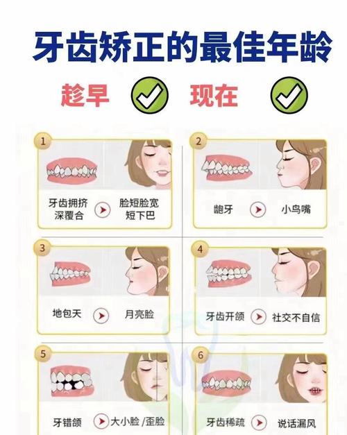 牙床畸形治疗方法-图2