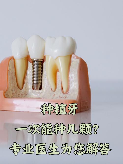 有牙根是否适合立即种牙？需满足哪些条件？-图3