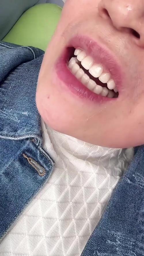 全口义齿修复，种牙真的是更好选择吗？-图2