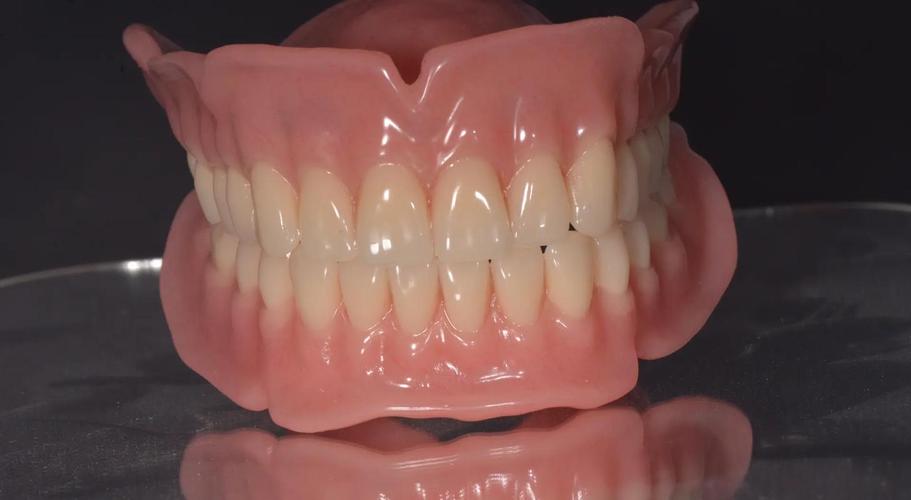 全口义齿修复，种牙真的是更好选择吗？-图1