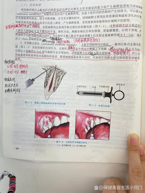 儿童口腔麻醉有哪些安全有效的方法？-图2