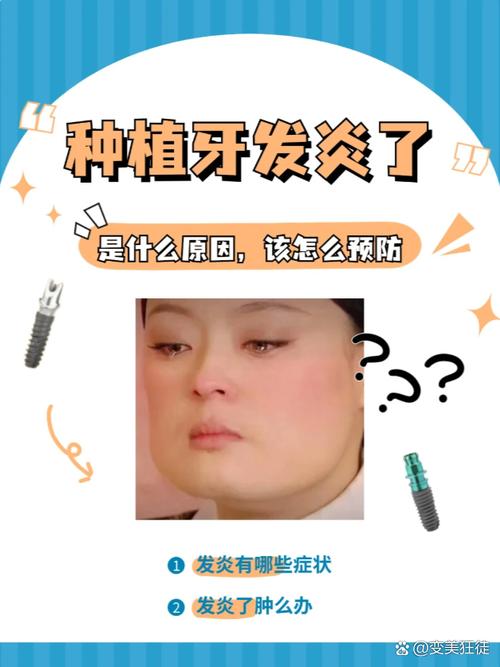 种牙感染怎么治疗-图3