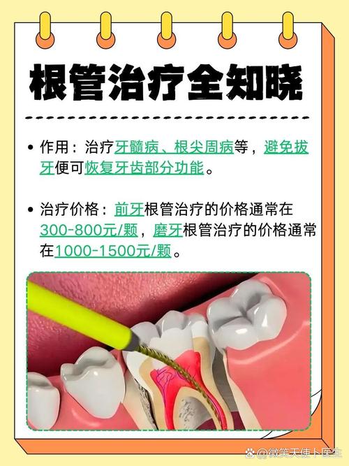 根尖穿孔如何有效拯救？方法有哪些？-图3