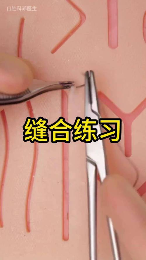 口腔缝合方法图片如何展示操作步骤与技巧？-图3