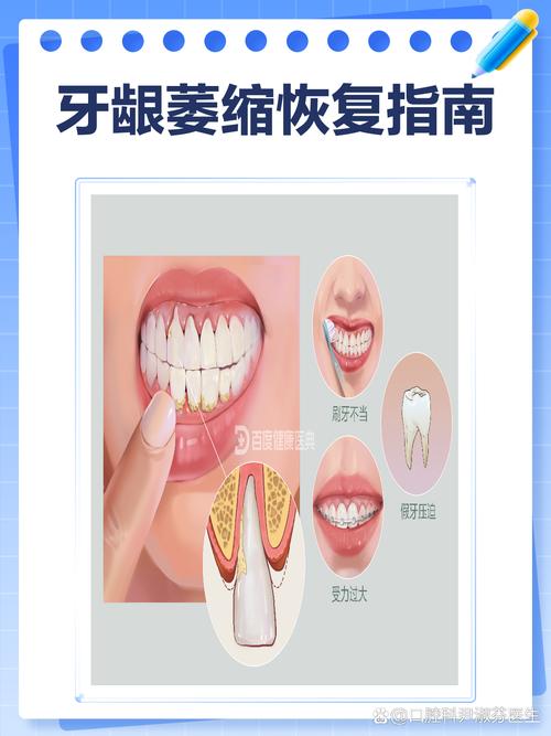 牙齿萎缩后，有哪些有效的补救方法？-图3