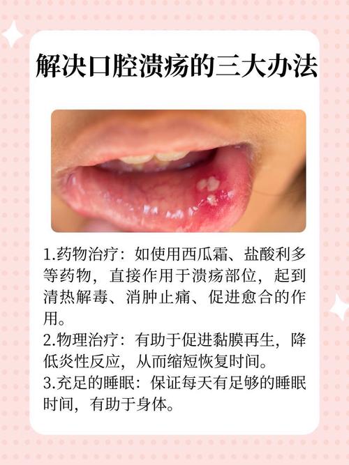 口疮快速治好，有哪些好方法？-图1