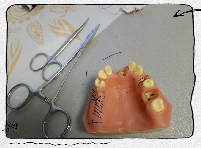 口腔手术缝合方法如何正确选择与操作？-图3