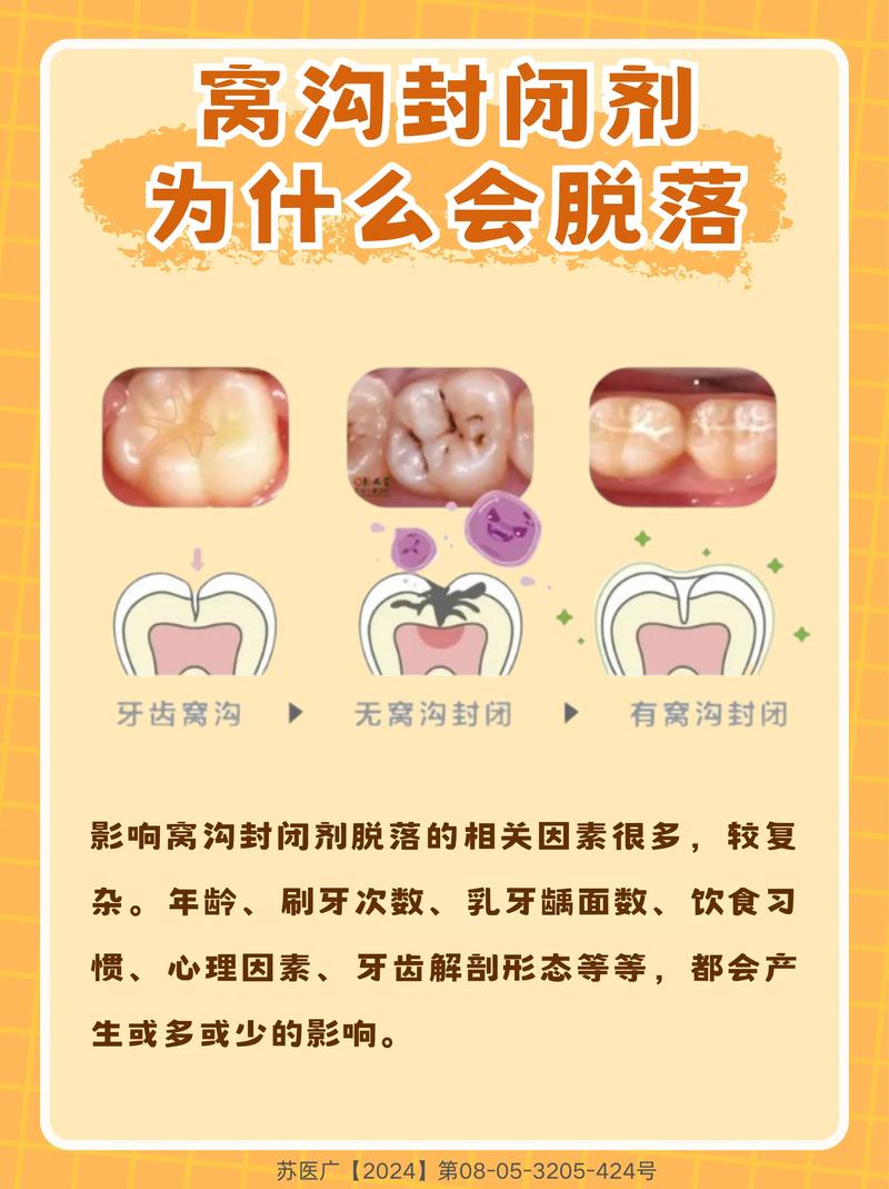 龋齿封闭治疗的效果和适用人群有哪些？-图1