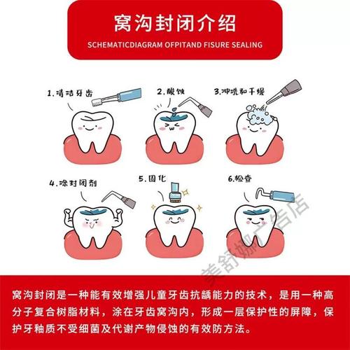 龋齿封闭治疗的效果和适用人群有哪些？-图2