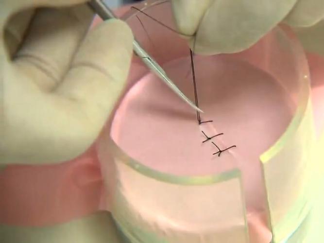 口腔常用缝合方法有哪些?如何选择合适的方法?-图1 口腔常用缝合方法有哪些?如何选择合适的方法?-图1