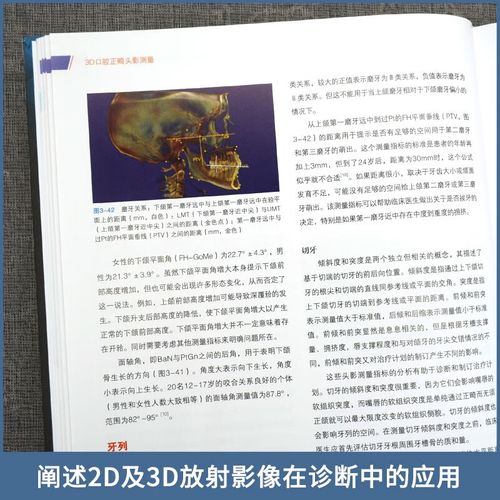 口腔正畸模型测量分析如何提升正畸精准度？-图3