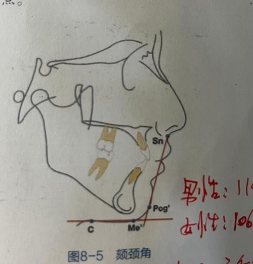 口腔正畸模型测量分析如何提升正畸精准度？-图2
