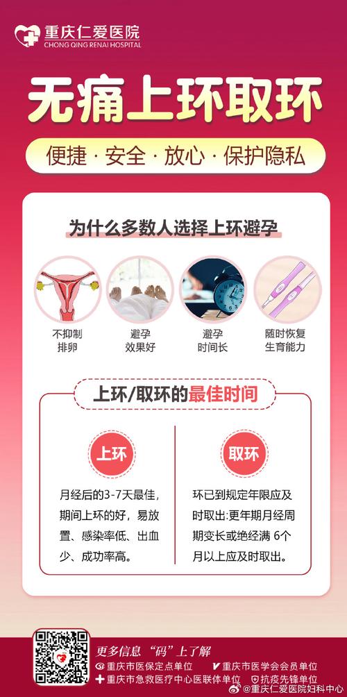 带环型号怎么选？关键因素有哪些？-图2