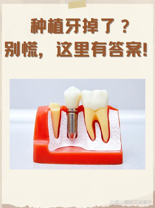 牙脱了可种回去吗-图1 牙脱了可种回去吗-图1