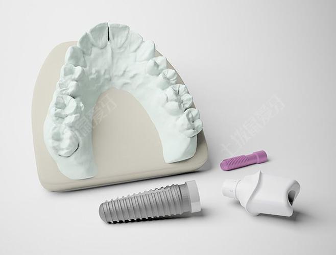 口腔种牙基台图片通常包含哪些类型和特点？-图3