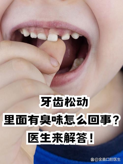 种牙会导致口腔异味吗？如何避免异味？-图1
