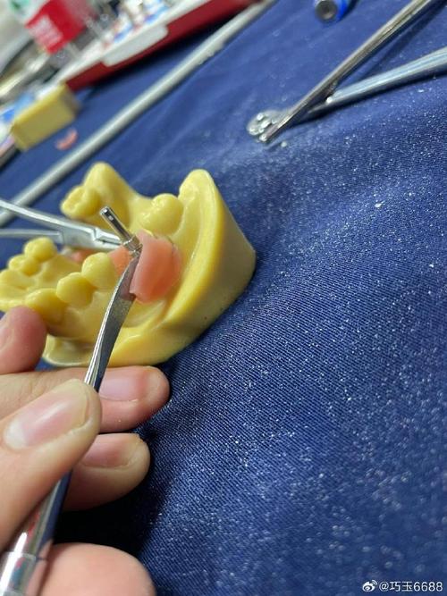 成都华西口腔种牙靠谱吗？效果和价格如何？-图1