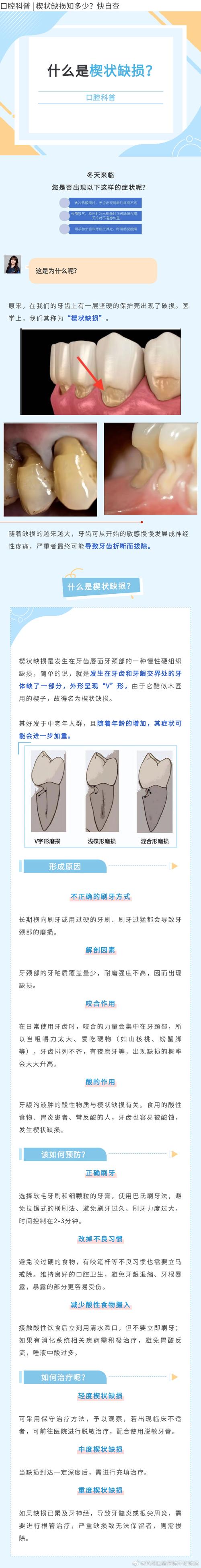 牙齿缺损记录方法-图2