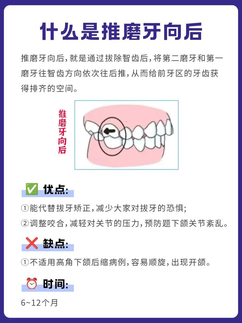 支抗磨牙后移的有效方法有哪些?-图2 支抗磨牙后移的有效方法有哪些?-图2