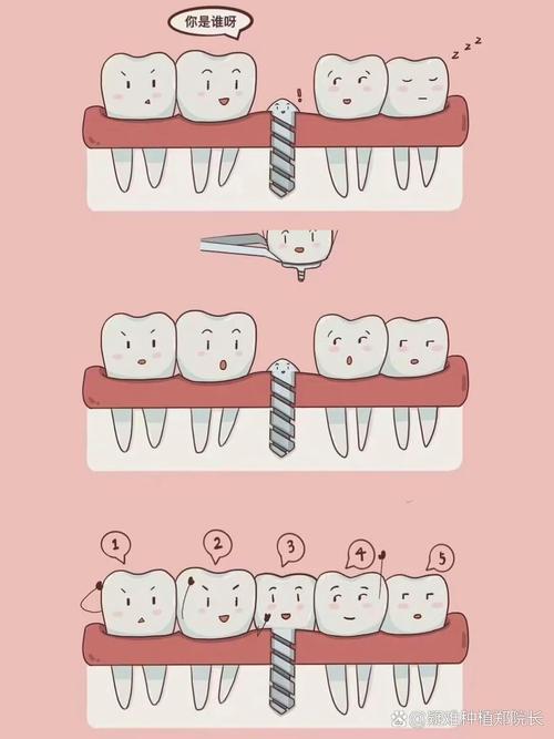 拜博口腔种牙技术效果如何？安全有保障吗？-图3